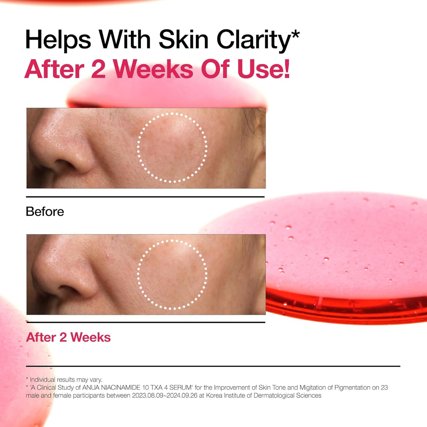 Niacinamide 10 + TXA 4 Serum
