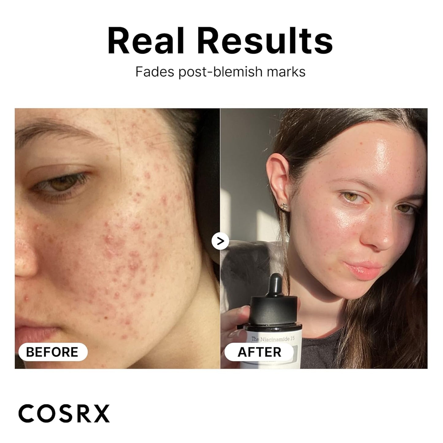 15% Niacinamide Face Serum