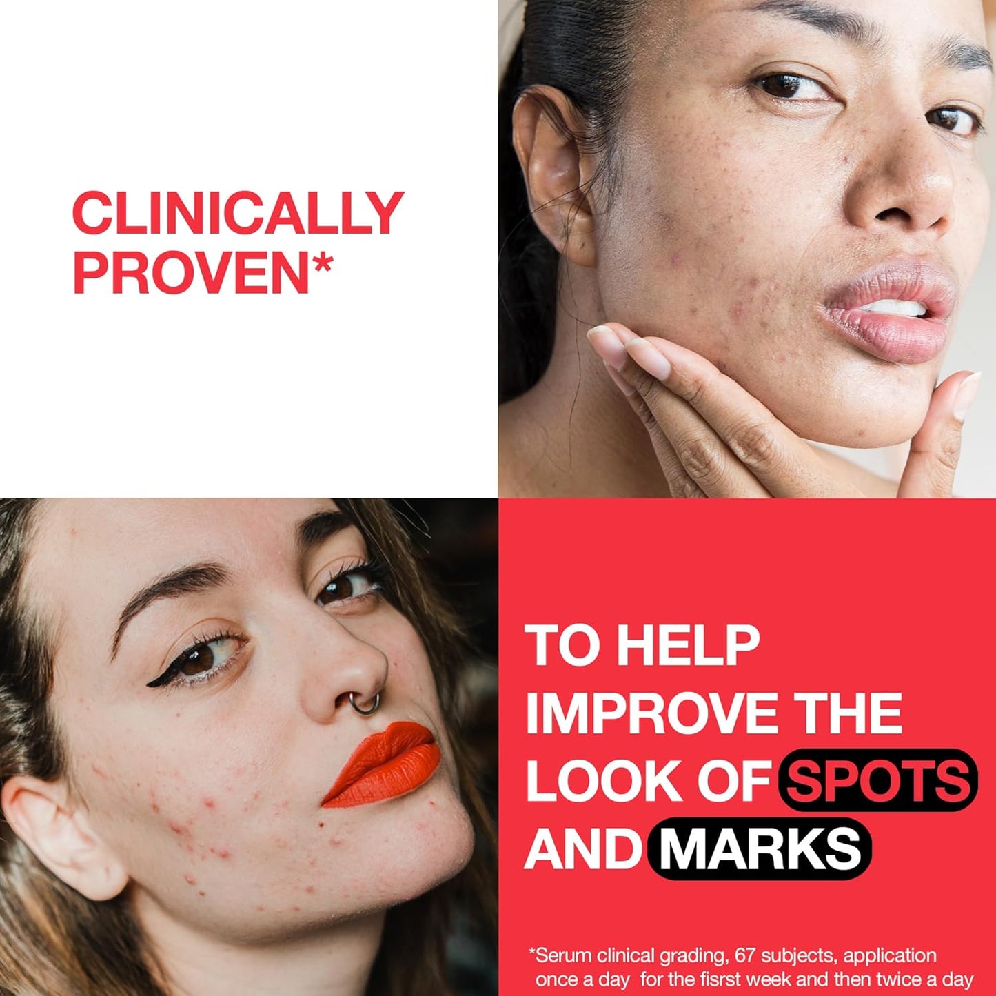 Facial Wash Spot Controlling+, Clearer Skin in 1 Week